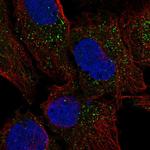 CRISPLD2 Polyclonal Antibody