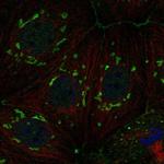 FAM222A Polyclonal Antibody
