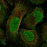 NF1 Polyclonal Antibody