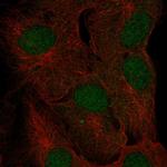 FAM228A Polyclonal Antibody