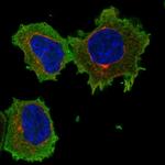 ARHGAP17 Polyclonal Antibody