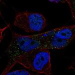 NLRC4 Polyclonal Antibody