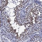 FAM134A Polyclonal Antibody