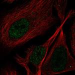 PPP1R3F Polyclonal Antibody