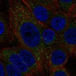 MTMR1 Polyclonal Antibody
