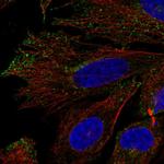 KV1.7 (KCNA7) Polyclonal Antibody