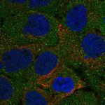 KHDC1L Antibody in Immunocytochemistry (ICC/IF)