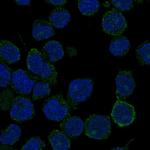 ANKRD30BL Polyclonal Antibody
