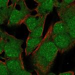 TBX10 Polyclonal Antibody