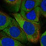 ZNF385A Polyclonal Antibody