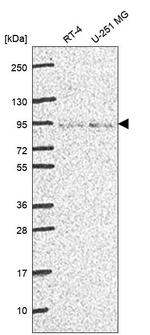 FOXP4 Antibody in Western Blot (WB)