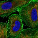 AJM1 Polyclonal Antibody