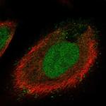 CT173 Polyclonal Antibody