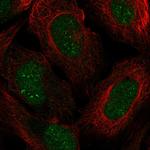 ZNF112 Polyclonal Antibody