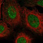 ZUFSP Antibody in Immunocytochemistry (ICC/IF)