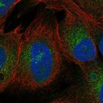 ZNF208 Polyclonal Antibody