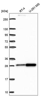 RPL10A Antibody in Western Blot (WB)
