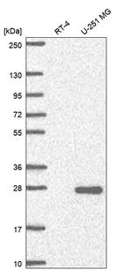 NCCRP1 Antibody in Western Blot (WB)
