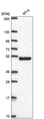 AP1M2 Antibody in Western Blot (WB)