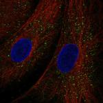 TEX36 Polyclonal Antibody