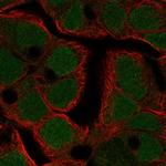 TFDP3 Polyclonal Antibody
