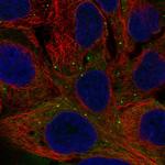 BNP Polyclonal Antibody