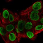 hnRNP A1L2 Polyclonal Antibody