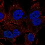 C10orf32 Polyclonal Antibody