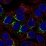 ARSI Polyclonal Antibody