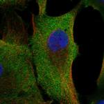 C20orf141 Polyclonal Antibody