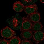 ARID2 Antibody in Immunocytochemistry (ICC/IF)