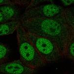 NHLRC1 Polyclonal Antibody