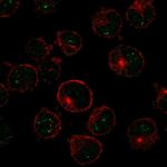 MSH5 Polyclonal Antibody