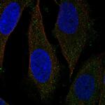 NUDT19 Polyclonal Antibody