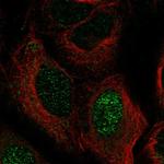 ZNF416 Polyclonal Antibody