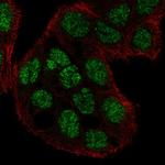 C2CD4A Polyclonal Antibody