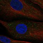 DIP13B Polyclonal Antibody