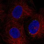 C1orf105 Polyclonal Antibody