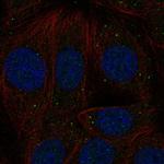INHBB Polyclonal Antibody