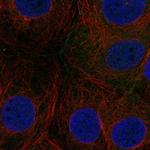 FAM209A Polyclonal Antibody