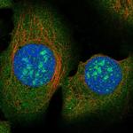 RAD51AP2 Polyclonal Antibody