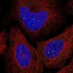 TTC9A Polyclonal Antibody