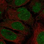 INAVA Polyclonal Antibody