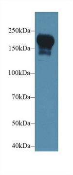 PIK3C2B Polyclonal Antibody
