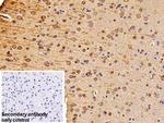 beta Tubulin Antibody in Immunohistochemistry (Paraffin) (IHC (P))