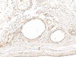 beta Tubulin Antibody in Immunohistochemistry (Paraffin) (IHC (P))