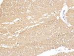 beta Tubulin Antibody in Immunohistochemistry (Paraffin) (IHC (P))