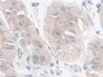 Galectin 9 Polyclonal Antibody