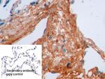 Procollagen I C-Peptide Antibody in Immunohistochemistry (Paraffin) (IHC (P))