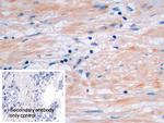 Procollagen I C-Peptide Polyclonal Antibody